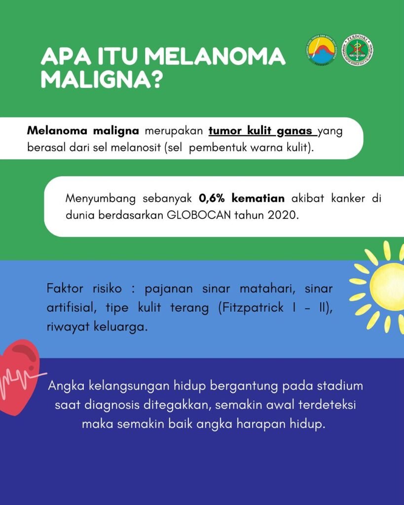 Melanoma 4