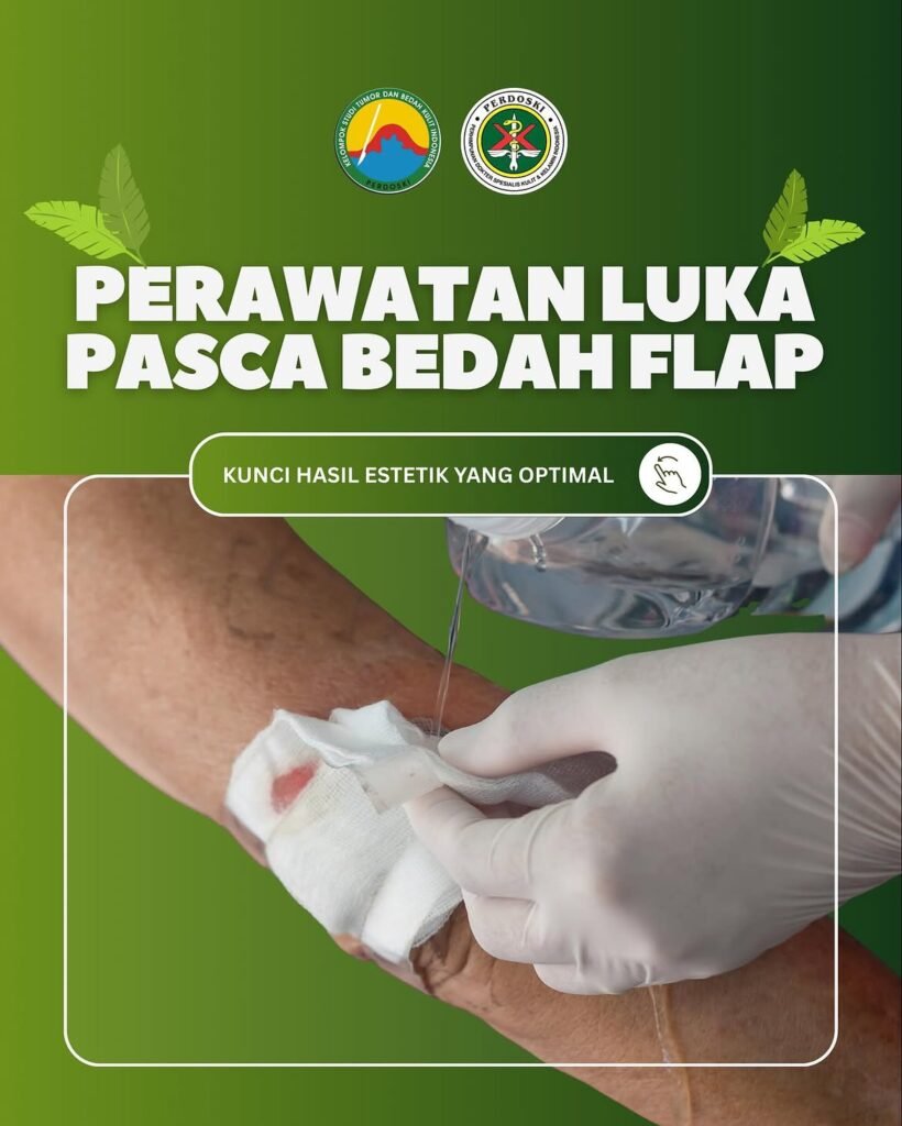 KSTBKI Flap1