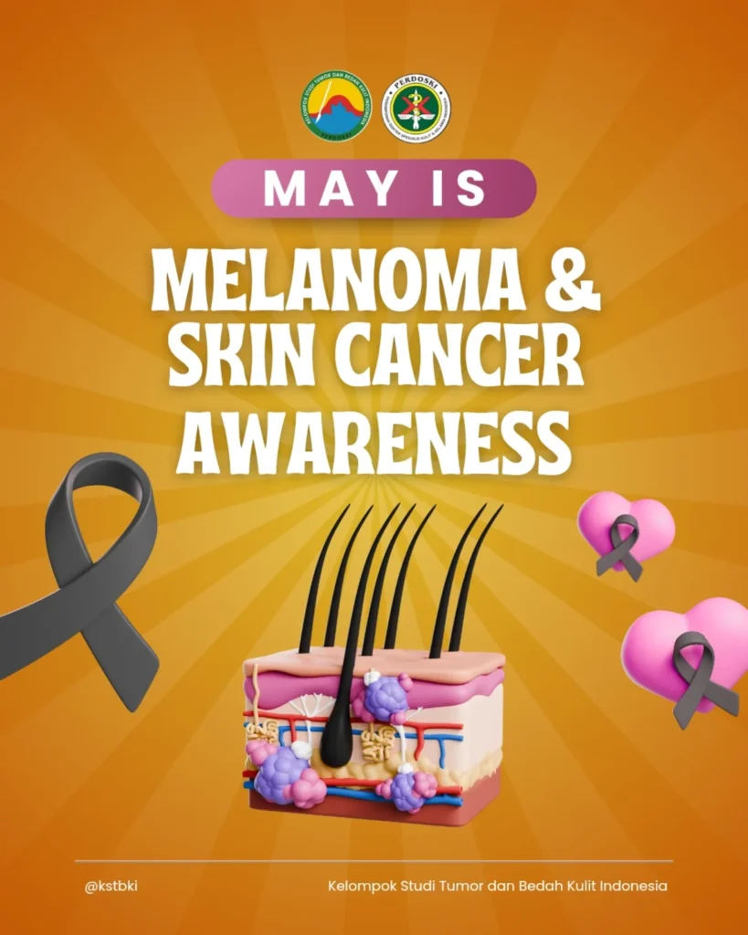 May is Melanoma & Skin Cancer Awareness Month: Kenali Tanda, Lindungi Kulit